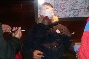 Мужчину ранил трос, оторвавшийся от памятника