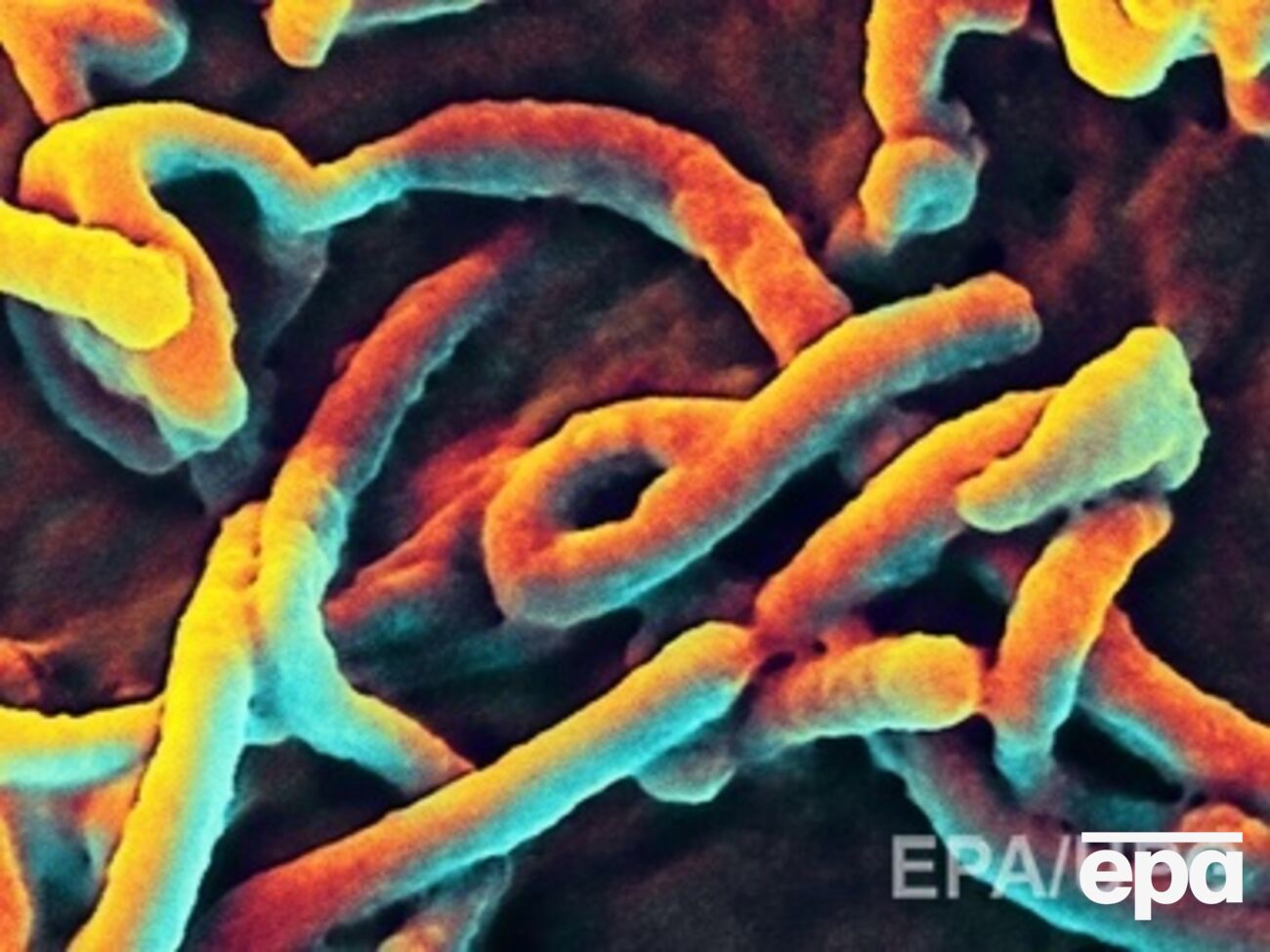 Эбола продолжает бушевать в африканских странах