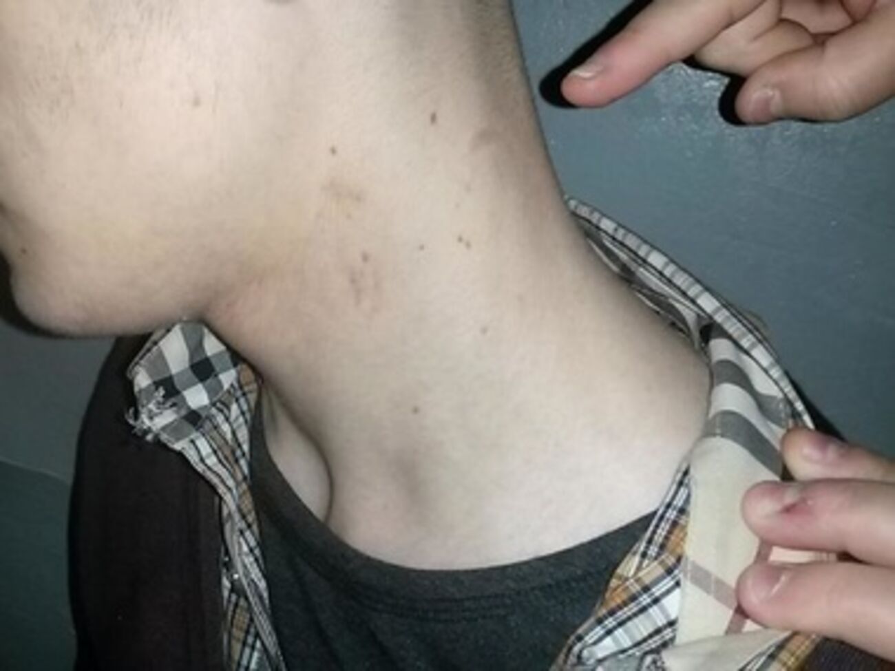 У задержанного видны синяки и следы от удушений