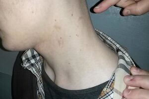 У задержанного видны синяки и следы от удушений