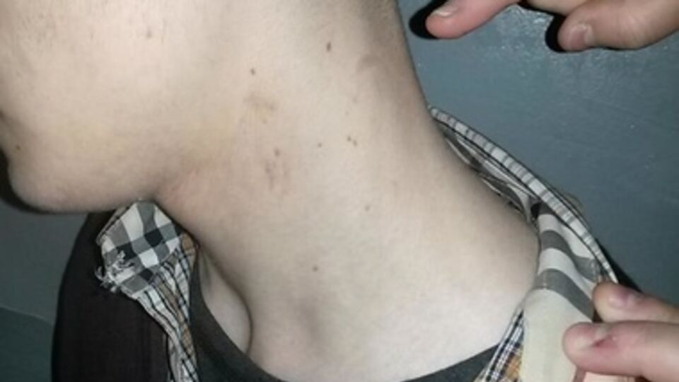 У задержанного видны синяки и следы от удушений