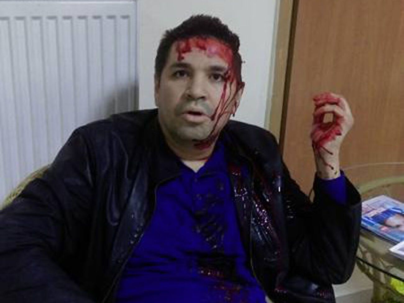 Анатолий Родзинский связывает нападение на себя с будущими выборами мэра Харькова