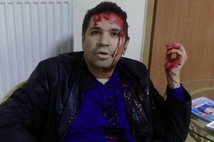 Анатолий Родзинский связывает нападение на себя с будущими выборами мэра Харькова