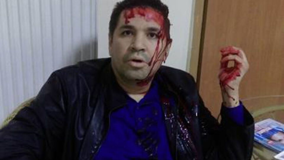 Анатолий Родзинский связывает нападение на себя с будущими выборами мэра Харькова