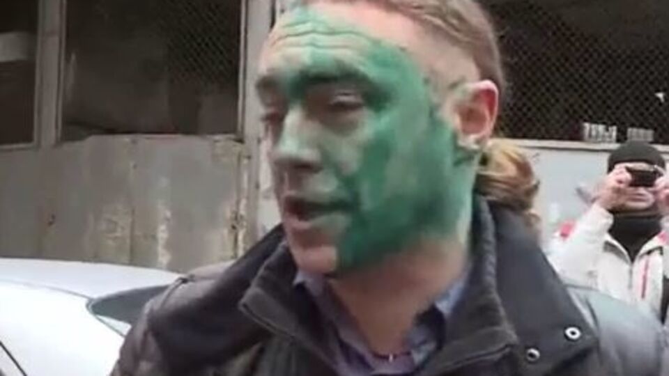 Кандидата в депутаты Киевсовета облили зеленкой