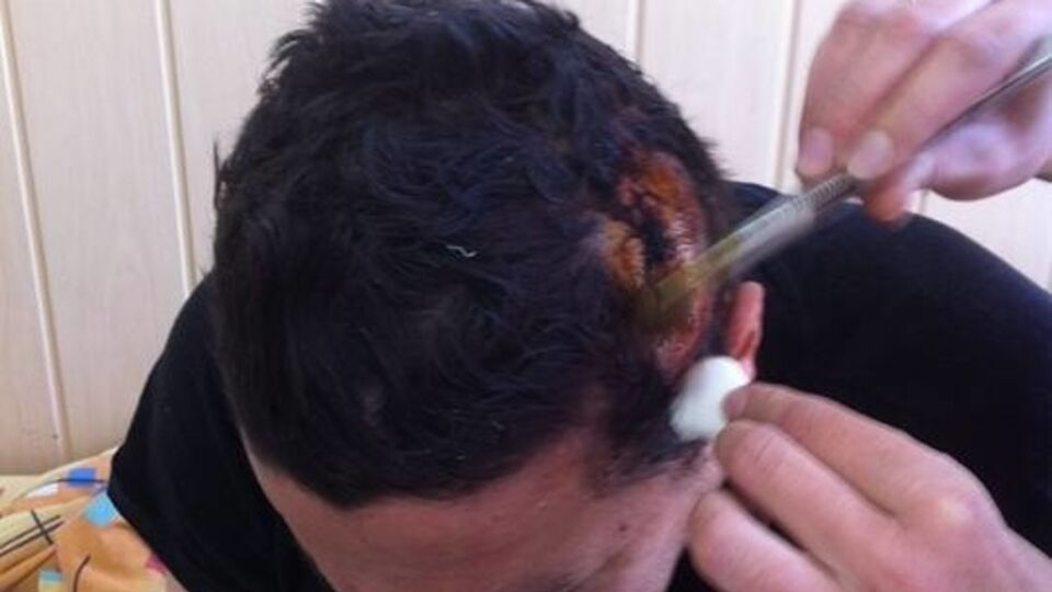 Родзинский: В городе, где есть Кернес, если ты начинаешь с ним бороться, тебе остается только умереть