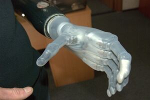Протез выполняет функции руки примерно на 65%, рассказывают бойцы. Можно брать предметы, водить скутер, завязать шнурки