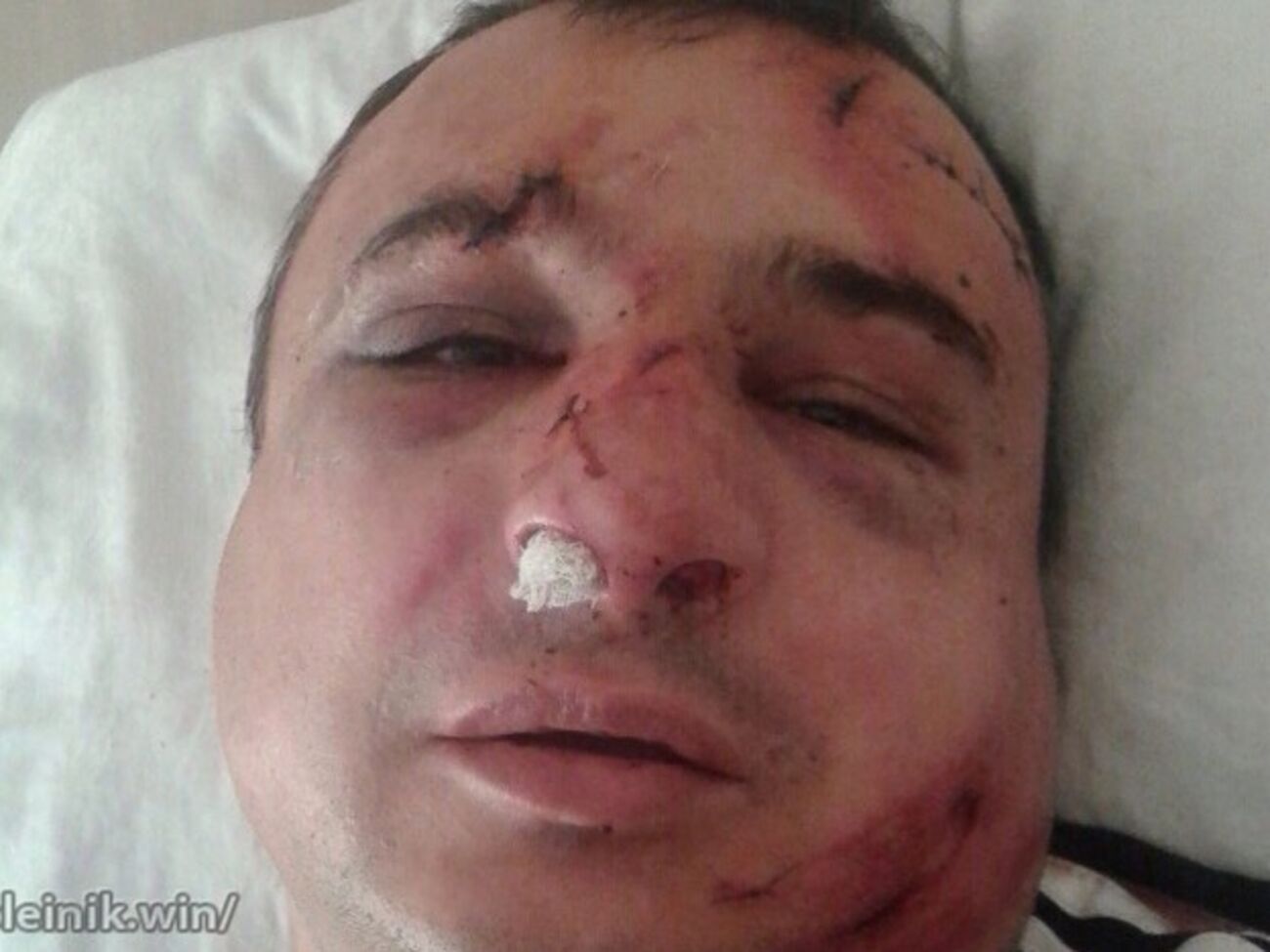 Клинчаева избили в одном из киевских кафе, сообщает "Информатор"