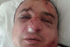 Клинчаева избили в одном из киевских кафе, сообщает "Информатор"