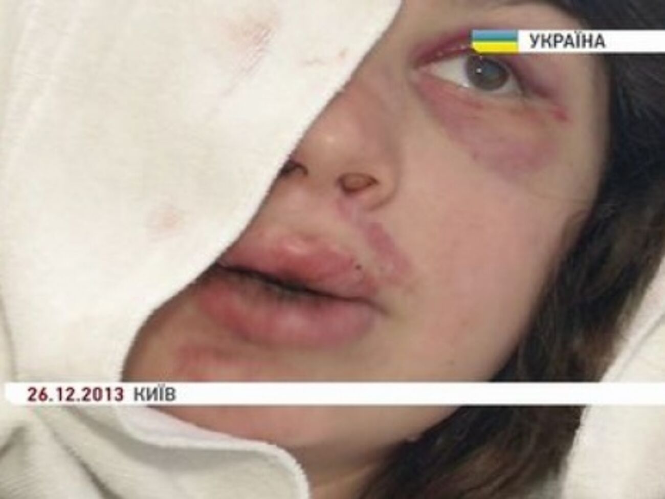 Черновол была избита на Бориспольском шоссе под Киевом в конце 2013 года