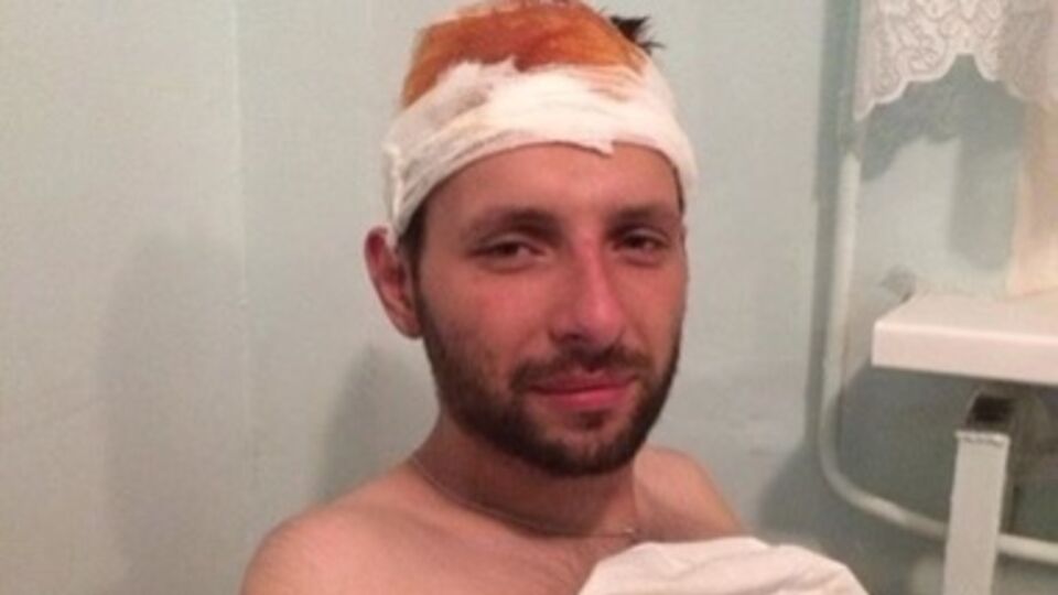 Владимир Парасюк после ранения