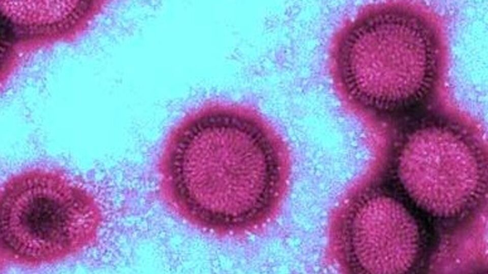 В Киеве лабораторно подтвержден первый случай смерти от гриппа в нынешнем эпидсезоне