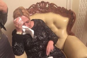 После инцидента Александра Кужель держалась за голову