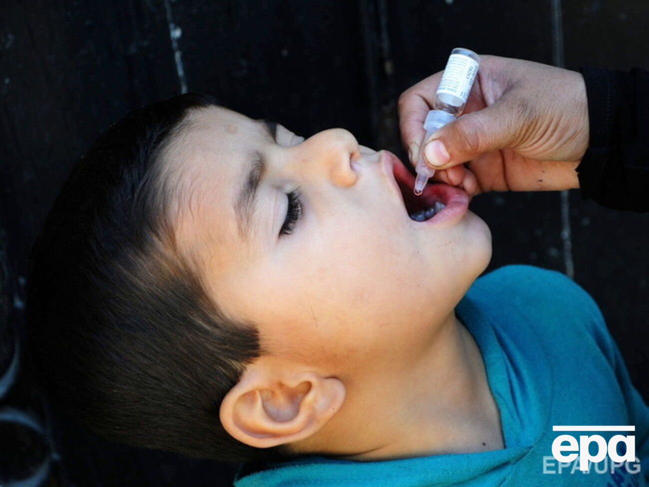 В ВОЗ обеспокоены низким уровнем вакцинации от полиомиелита в Украине