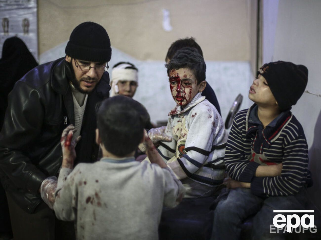 Сирийцы получают первую помощь в полевом госпитале после авиаудара, нанесенного силами, лояльными к сирийскому правительству, в занятом повстанцами городе Дума в предместье Дамаска – говорится в описании этой фотографии фотоагентства EPA