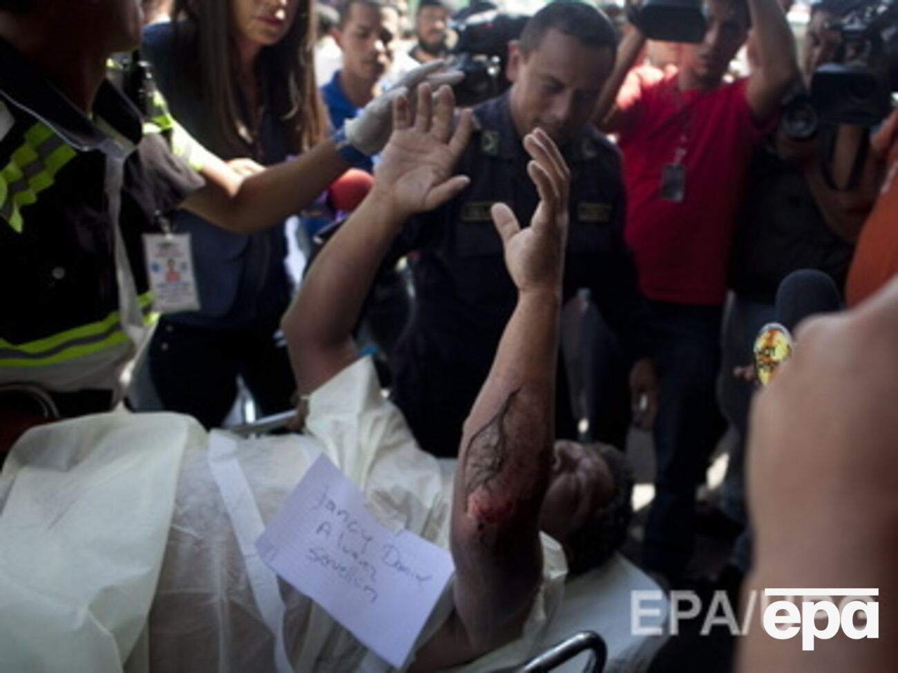 46 человек пришлось госпитализировать