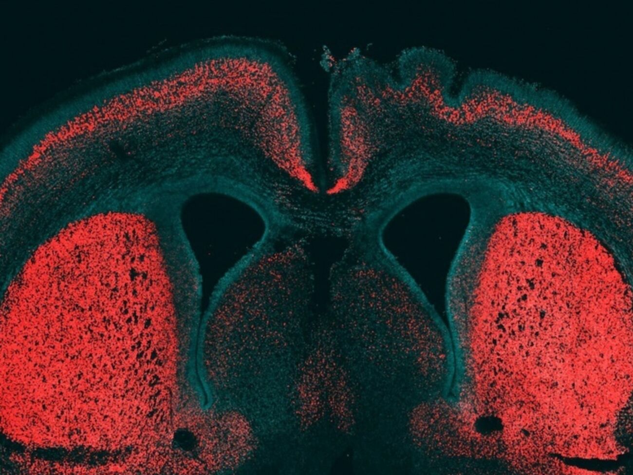 Ученые нашли ген, делающий мозг человека уникальным