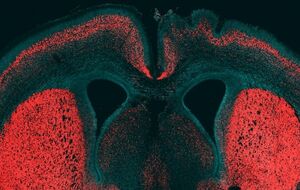 Ученые нашли ген, делающий мозг человека уникальным