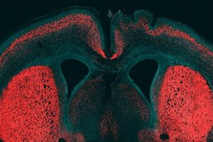 Ученые нашли ген, делающий мозг человека уникальным
