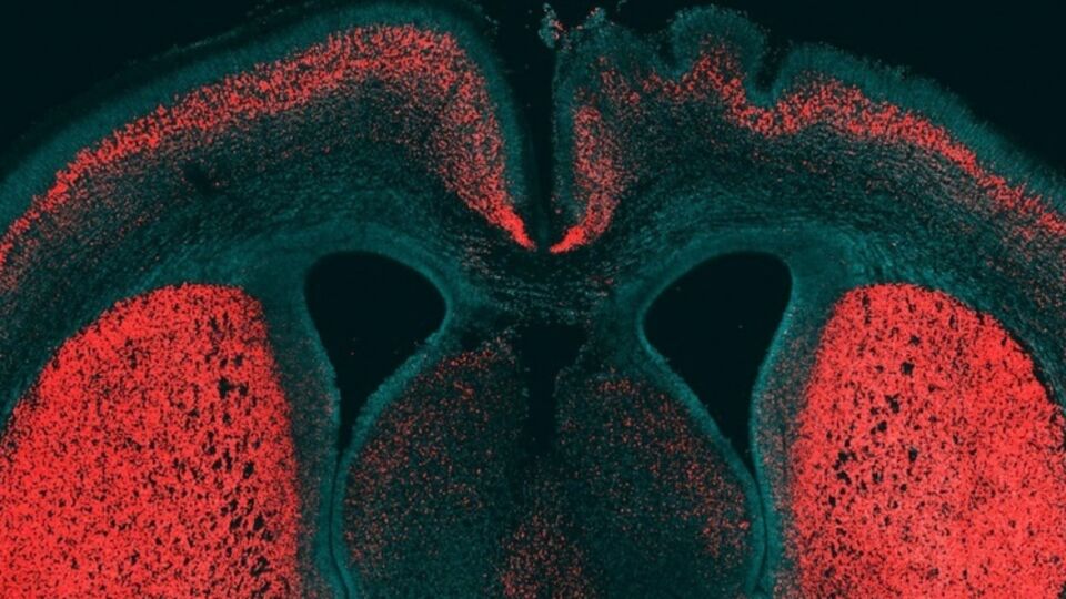 Ученые нашли ген, делающий мозг человека уникальным