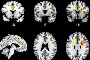 "Любовная карта" мозга