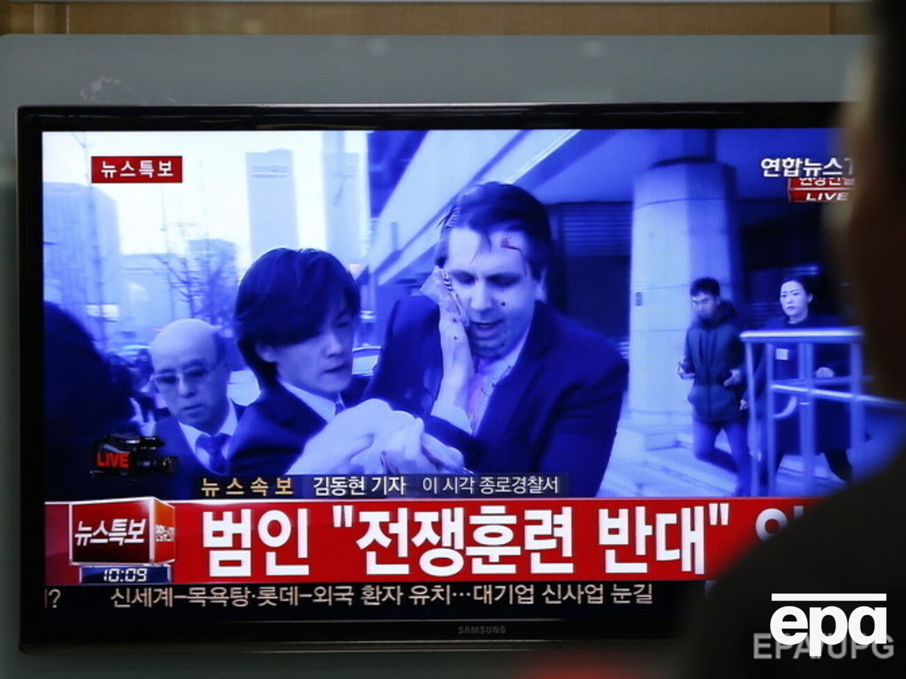 Активист атаковал посла США и порезал его