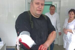 Андрей Янголенко после покушения