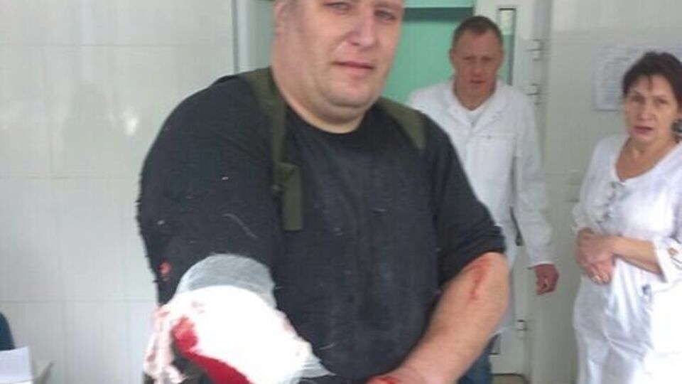 Андрей Янголенко после покушения