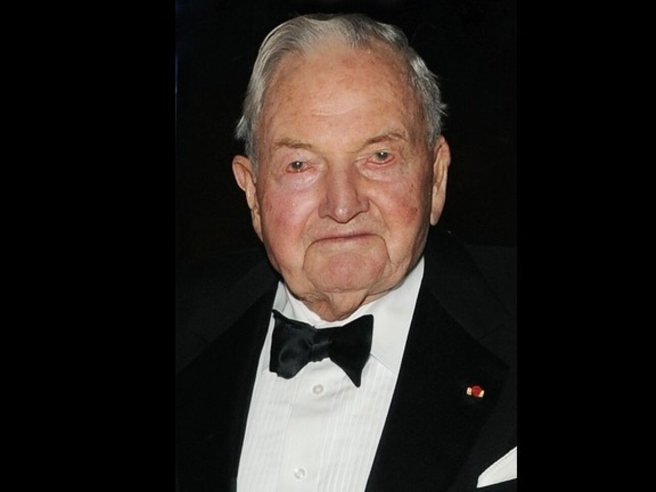 Первую трансплантацию сердца Рокфеллер перенес в 1976 году