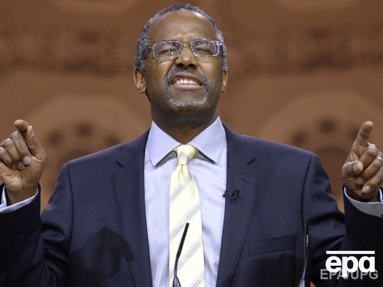 Карсон заявил, что нашел бы "другие" способы разрешить конфликт в Украине