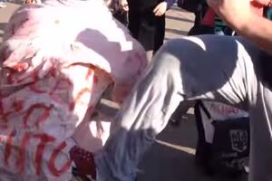 Момент избиения активистов "Відсічі" ногами
