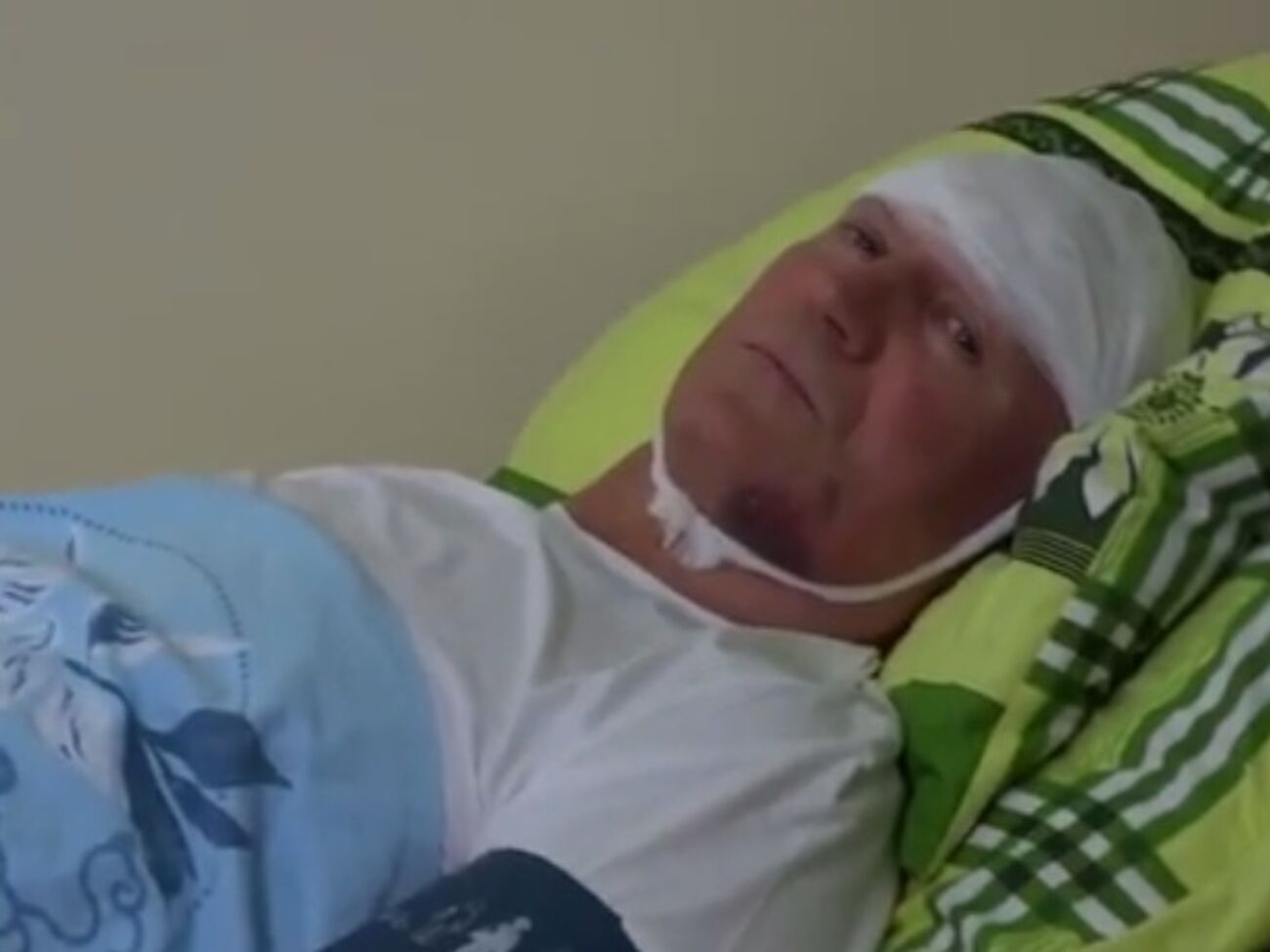 После избиения у Валерия Запорожана диагностировали закрытую черепно-мозговую травму, ушиб головного мозга и многочисленные травмы мягких тканей