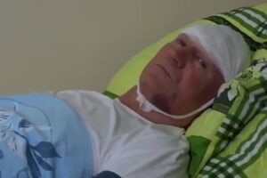 После избиения у Валерия Запорожана диагностировали закрытую черепно-мозговую травму, ушиб головного мозга и многочисленные травмы мягких тканей