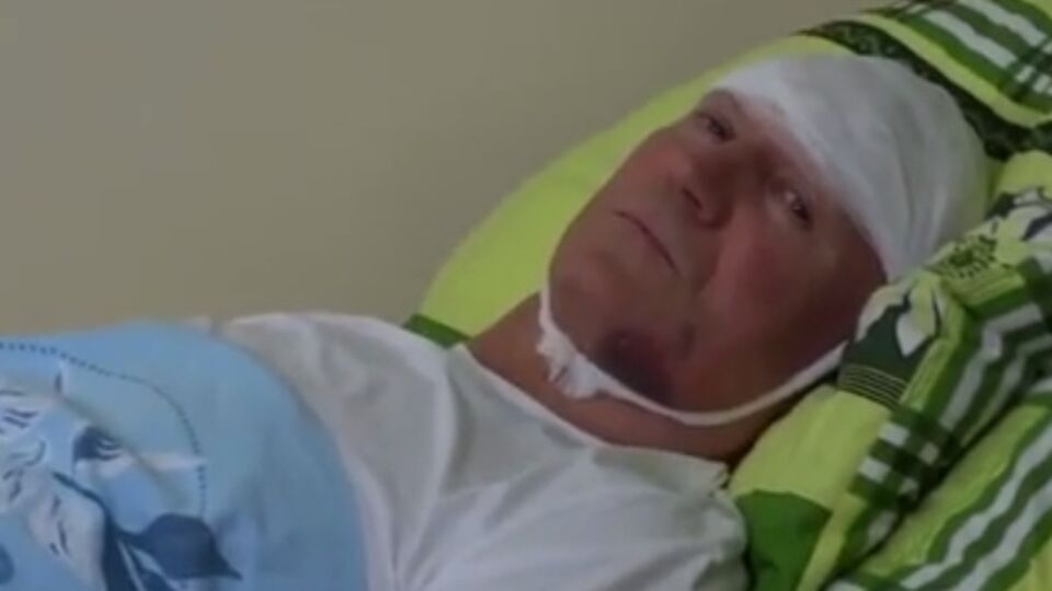 После избиения у Валерия Запорожана диагностировали закрытую черепно-мозговую травму, ушиб головного мозга и многочисленные травмы мягких тканей