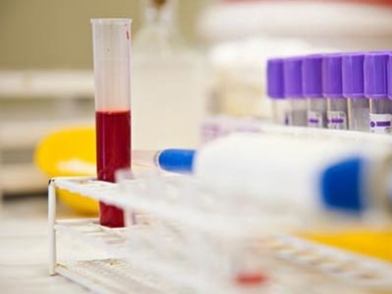 СМИ: Образцы крови жительницы Уссурийска отправили в вирусологическую лабораторию Новосибирска