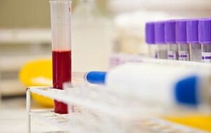 СМИ: Образцы крови жительницы Уссурийска отправили в вирусологическую лабораторию Новосибирска