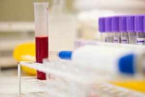 СМИ: Образцы крови жительницы Уссурийска отправили в вирусологическую лабораторию Новосибирска