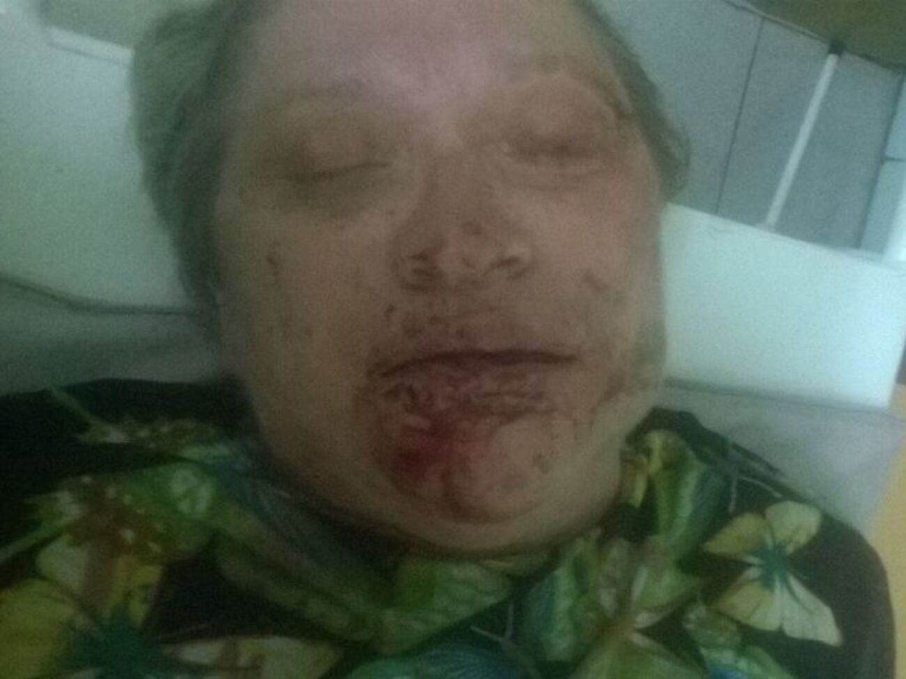 Избитая Любовь Корсакова жестко критиковала главаря боевиков Плотницкого