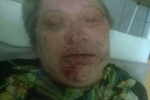 Избитая Любовь Корсакова жестко критиковала главаря боевиков Плотницкого