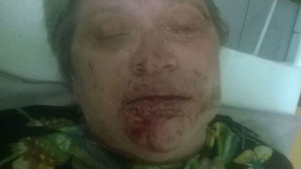 Избитая Любовь Корсакова жестко критиковала главаря боевиков Плотницкого