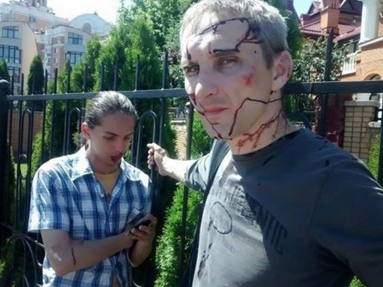 Один из пострадавших