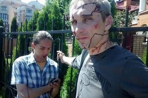 Один из пострадавших