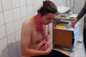 В городе Олевск избили активиста Олександра Николайчука, который борется с массовой нелегальной добычей янтаря