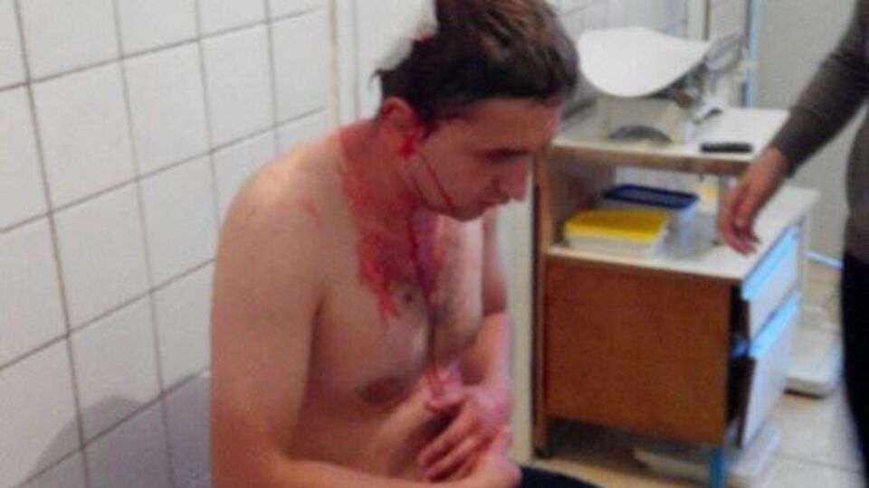 В городе Олевск избили активиста Олександра Николайчука, который борется с массовой нелегальной добычей янтаря