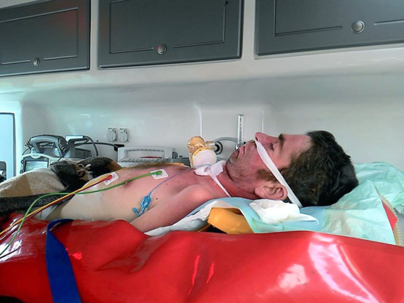 Роман Капаций находится в коме