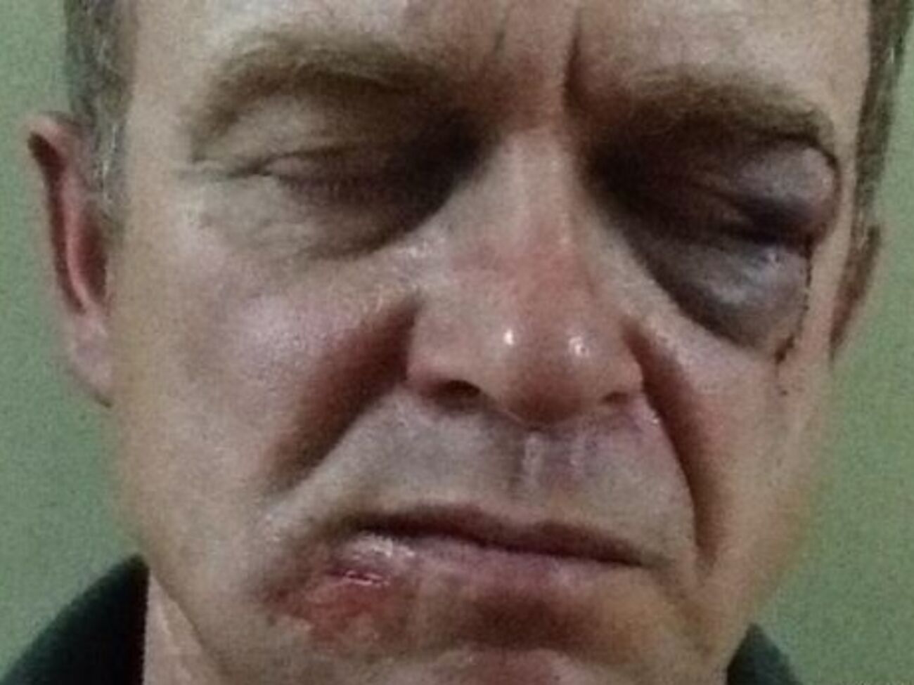 Александр Кулибабчук после избиения