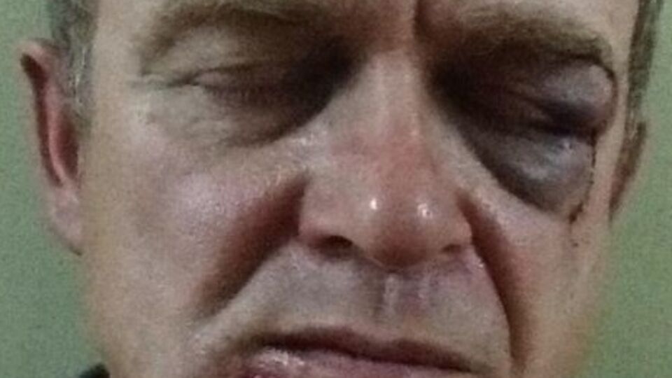 Александр Кулибабчук после избиения