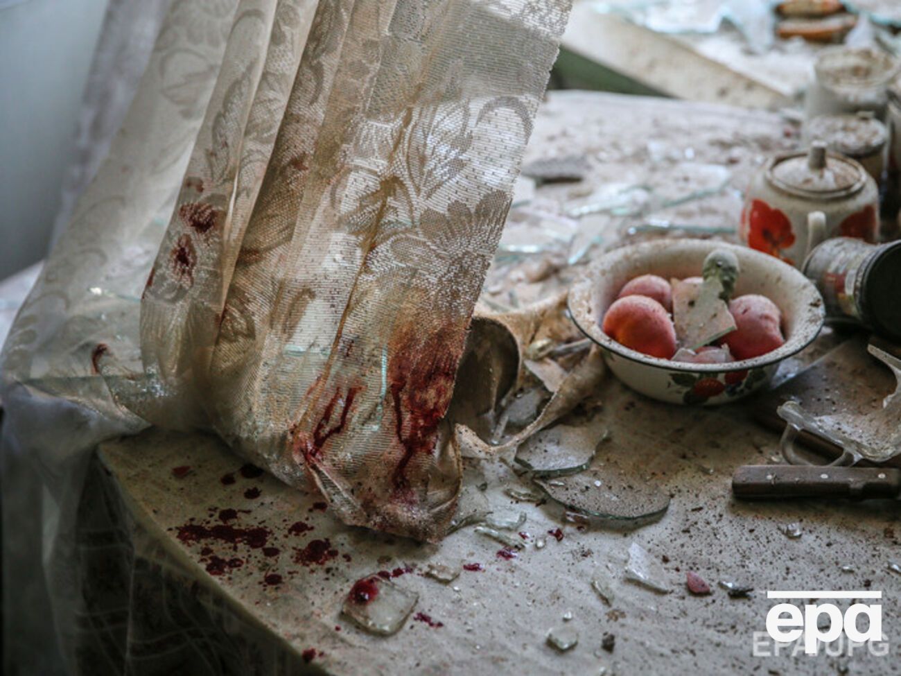 В результате обстрелов на Донбассе ранения получают и военные, и мирные жители