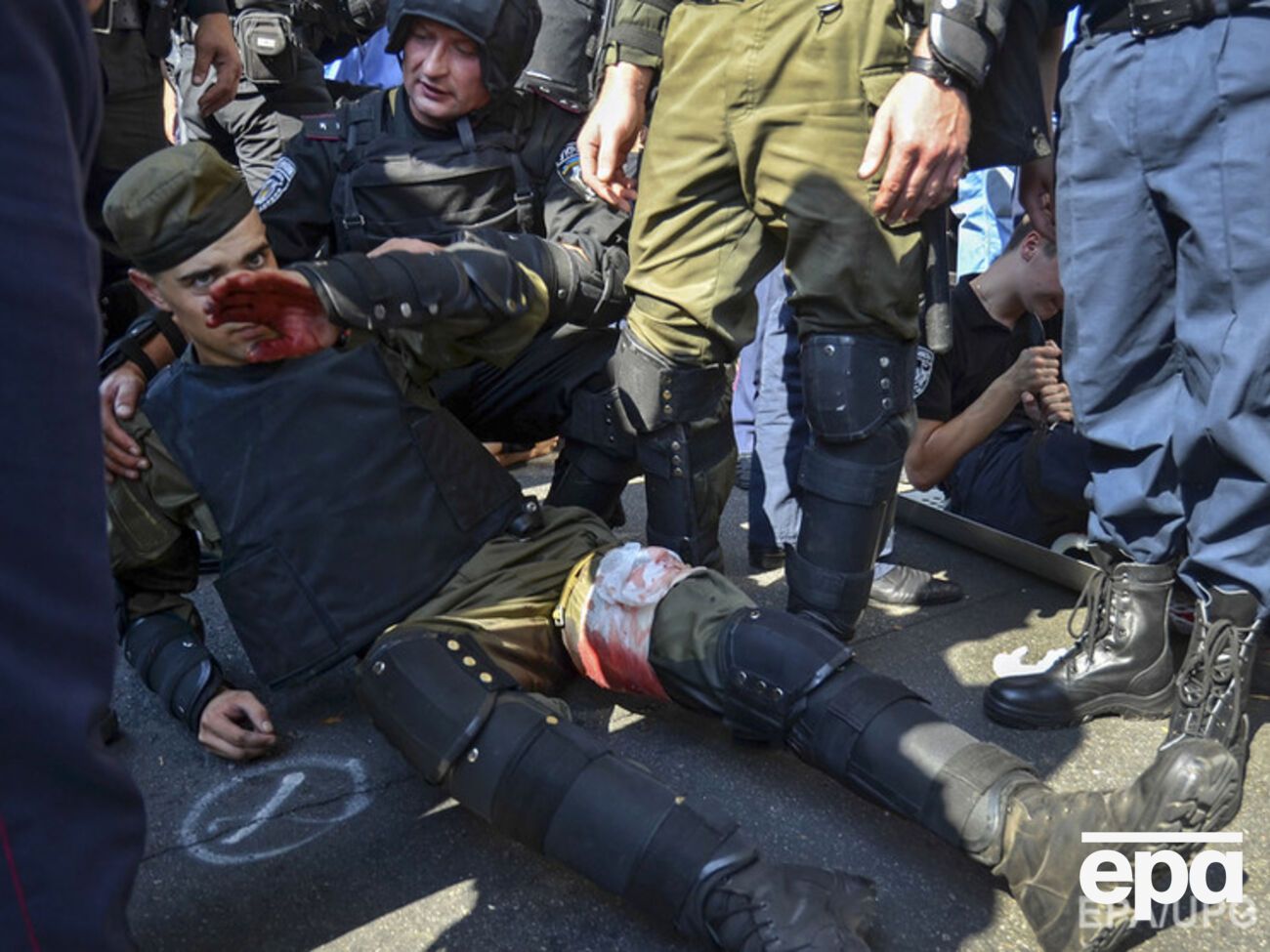 Аваков:&nbsp;Один убитый, 125 раненых, 12 человек на операционных столах, один боец в тяжелой коме, и врачи пока не дают прогнозов еще пятерым