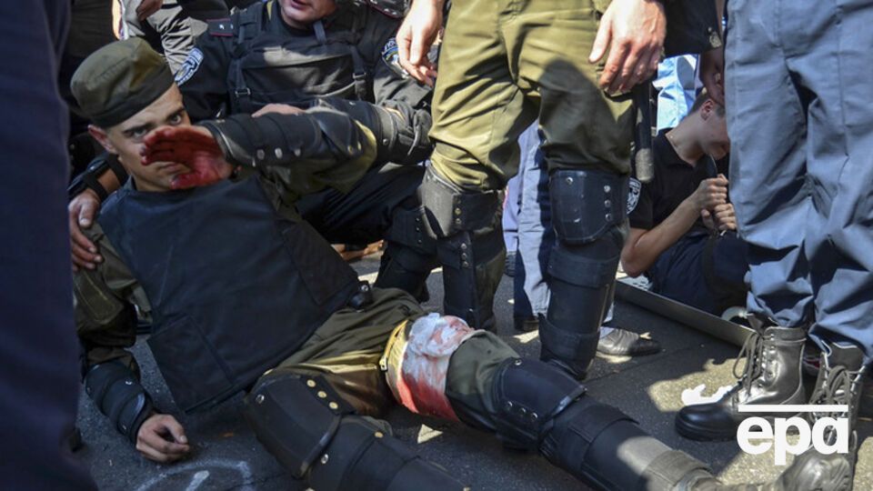 Аваков: Один убитый, 125 раненых, 12 человек на операционных столах, один боец в тяжелой коме, и врачи пока не дают прогнозов еще пятерым